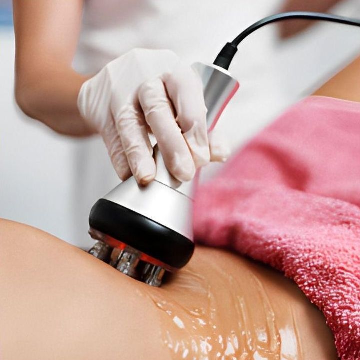 Un applicateur de radiofréquence passé sur la cuisse avec un gel.
