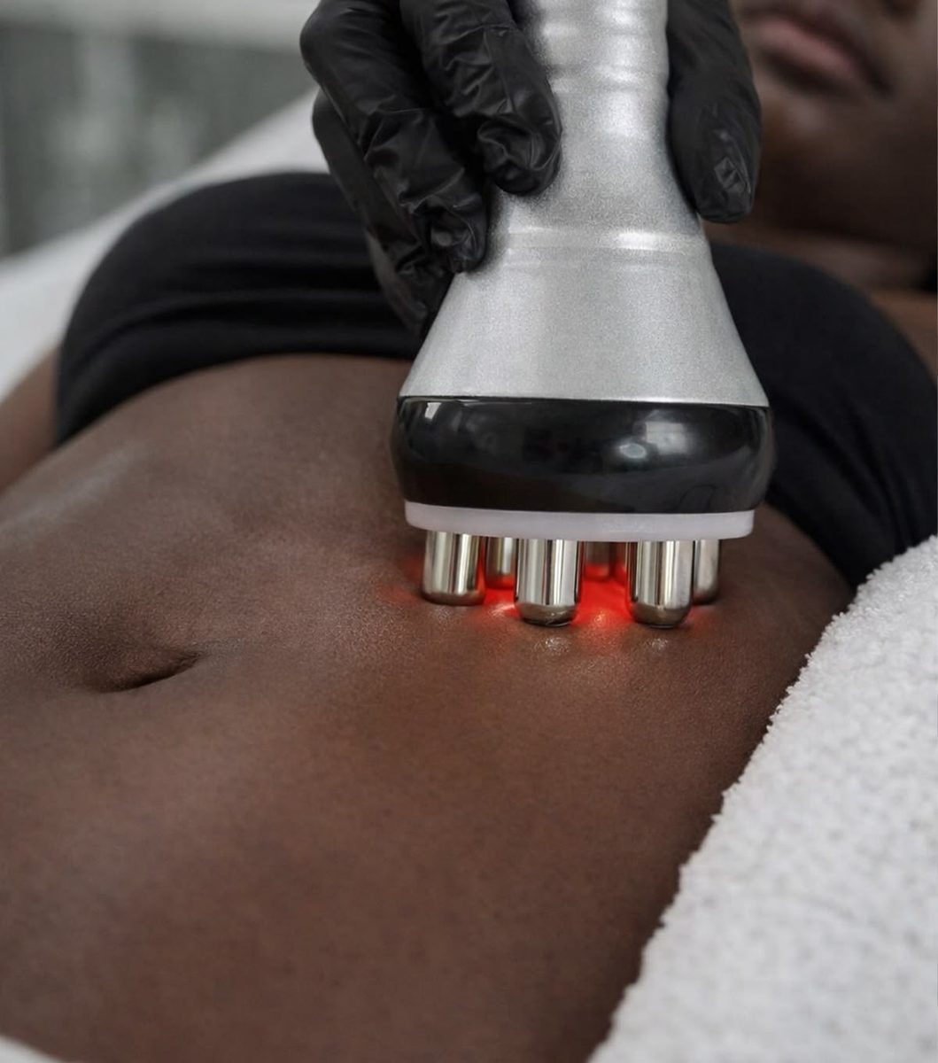 Un applicateur de radiofréquence à lumière rouge appliqué sur le ventre d'une cliente.